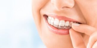 Invisalign braces cost in UK