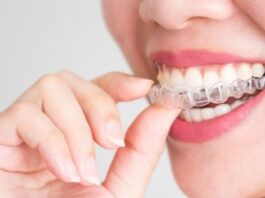 London-based Invisalign provider