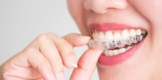 London-based Invisalign provider