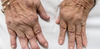 Can Regenerative Medicine Help You Get Rid of Arthritis